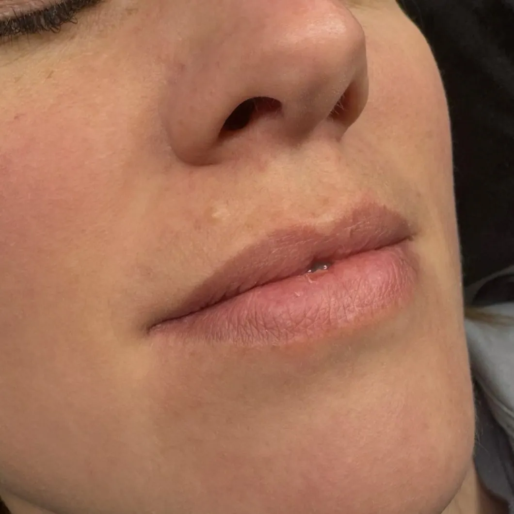 Lippen vor dem Permanent Make-up, natürliche Lippenfarbe